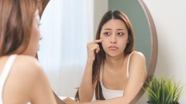 Dermatologist-Recommended Tips for Revitalizing Puffy Eyes After a Long Flight
